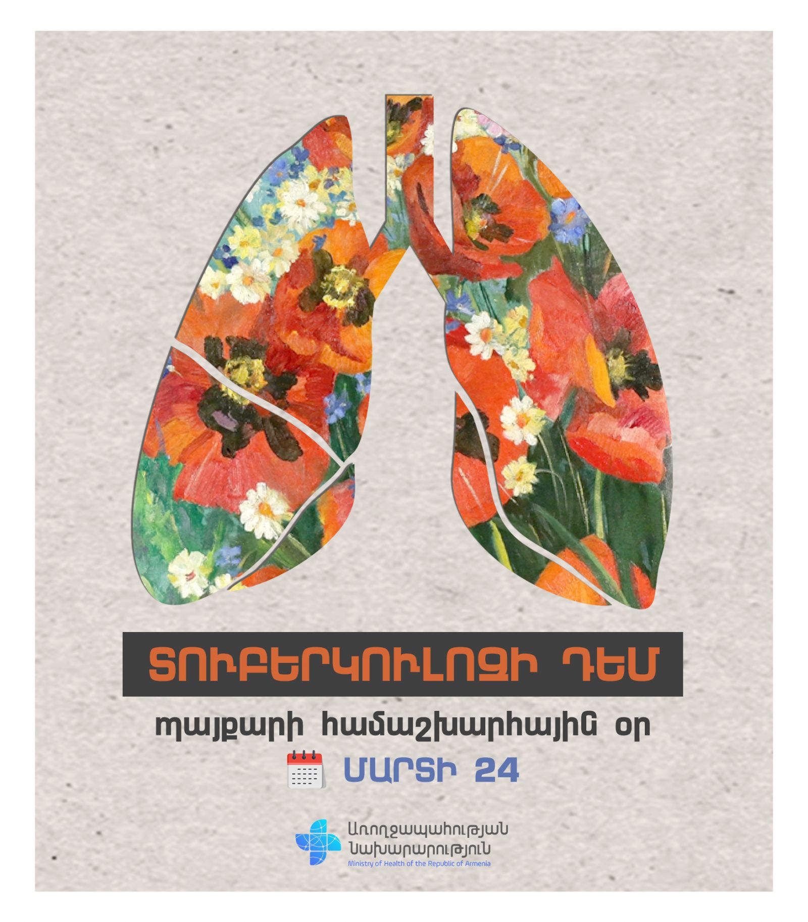 Pada tahun 2022, tercatat 472 kasus tuberkulosis aktif di Armenia