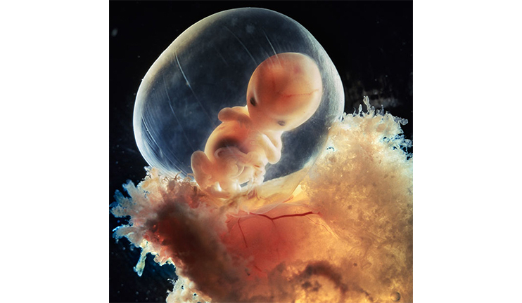 Story of One Photo: Unique intrauterine shot