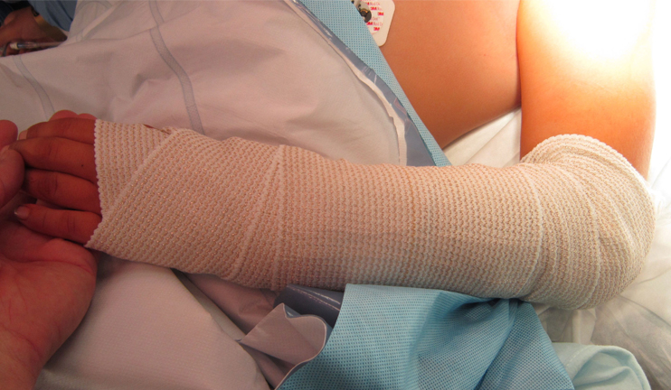 Առողջ առավոտ. Առաջին օգնություն՝ կոտրվածքի դեպքում