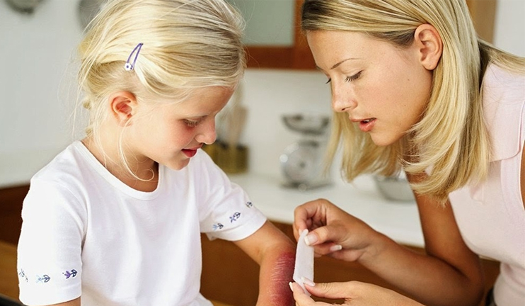 Առողջ առավոտ. Առաջին օգնություն այրվածքներին