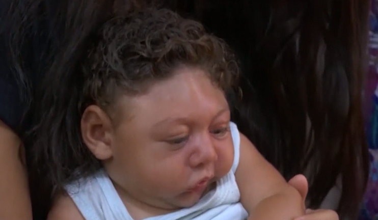 Զիկա տենդով վարակվածներ կան ԱՄՆ-ում, Եվրոպայում, մեկ դեպք էլ՝ Ռուսաստանում