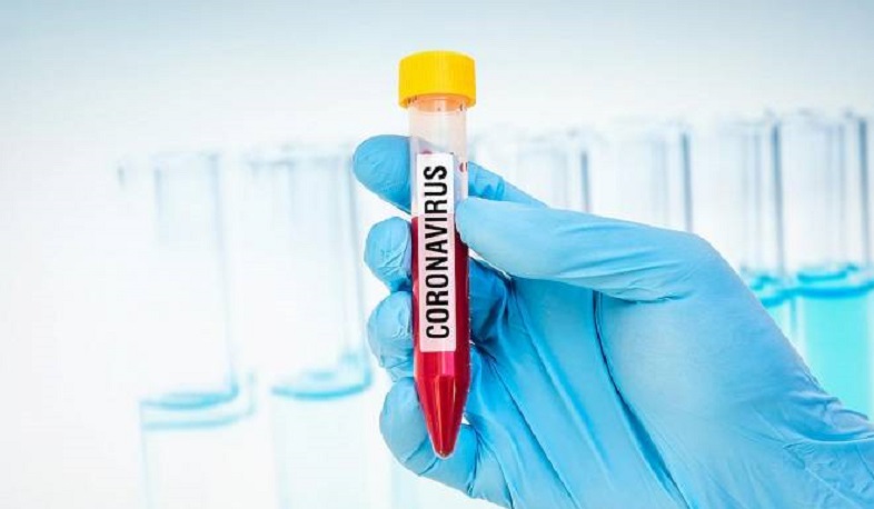 Four new cases of coronavirus have been confirmed in Artsakh, a total of 33