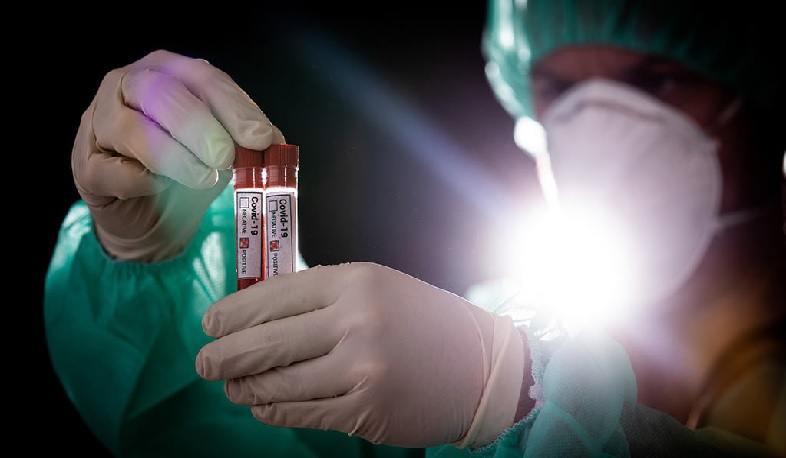 Թեստավորման 10 նմուշի պատասխանը բացասական է․ Արցախի տեղեկատվական կենտրոն