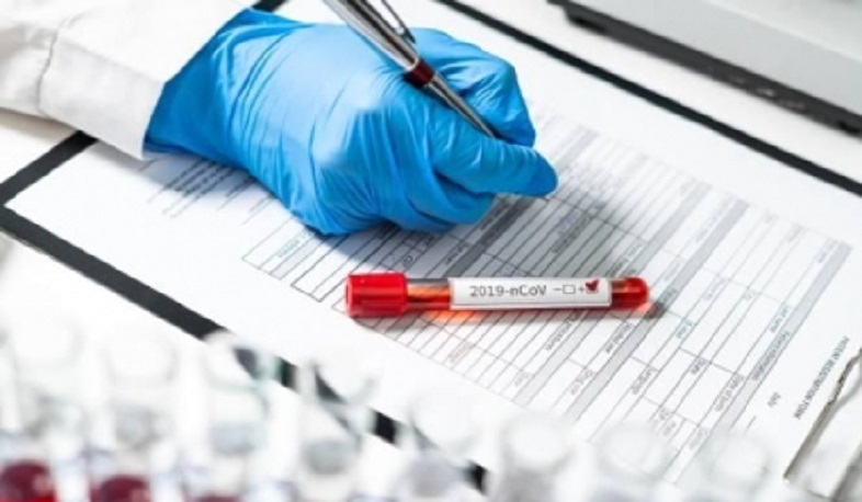 Արցախում ստացվել են կորոնավիրուսի 44 թեստի արդյունքները