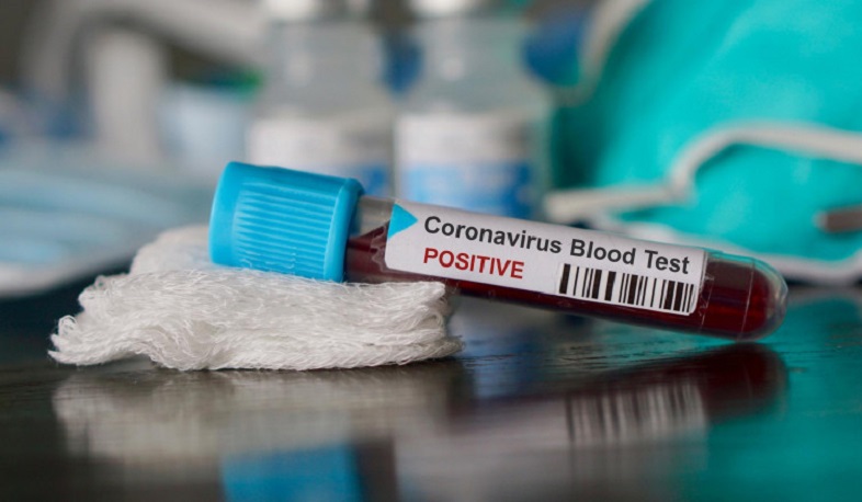 Գյումրու ինֆեկցիոն հիվանդանոցում կորոնավիրուսով 47 հիվանդ է բուժվում