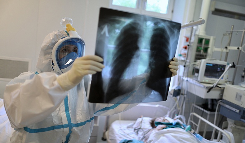 Ռուսաստանում մեկ օրում մահացել է 174 վարակված. РИА Новости