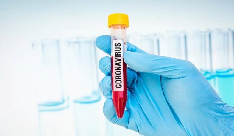 Գյումրու ինֆեկցիոն հիվանդանոցում կորոնավիրուսով 84 հիվանդ է բուժվում