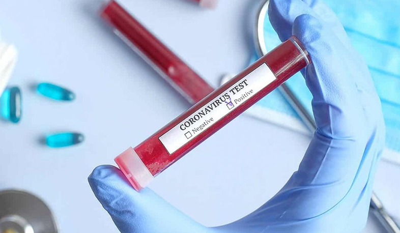 Սյունիքի մարզում այս պահին կա կորոնավիրուսի 123 հաստատված դեպք. մարզպետարան