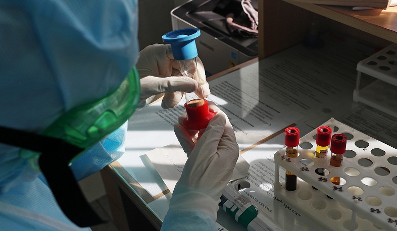 Ռուսաստանը կորոնավիրուսի պատվաստանյութի արտադրությունը կսկսի սեպտեմբերին. Russia Today