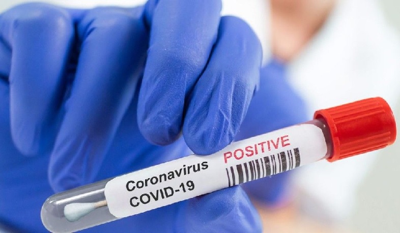 There are 79 confirmed cases of coronavirus in Artsakh
