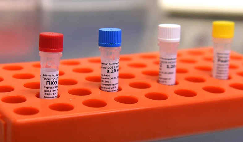 Որ լաբորատորիաներում են իրականացվում կորոնավիրուսի հետազոտություններ