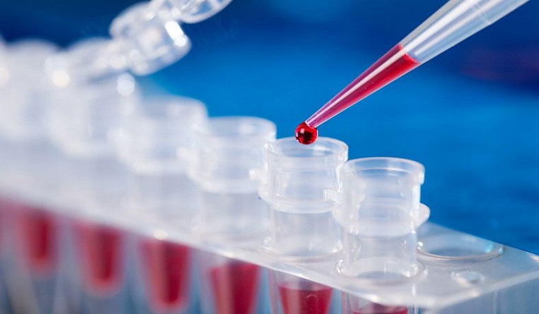 Գյումրու ինֆեկցիոն հիվանդանոցում կորոնավիրուսով 87 հիվանդ է բուժվում