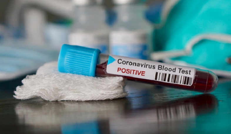4 new cases of coronavirus have been confirmed in Artsakh