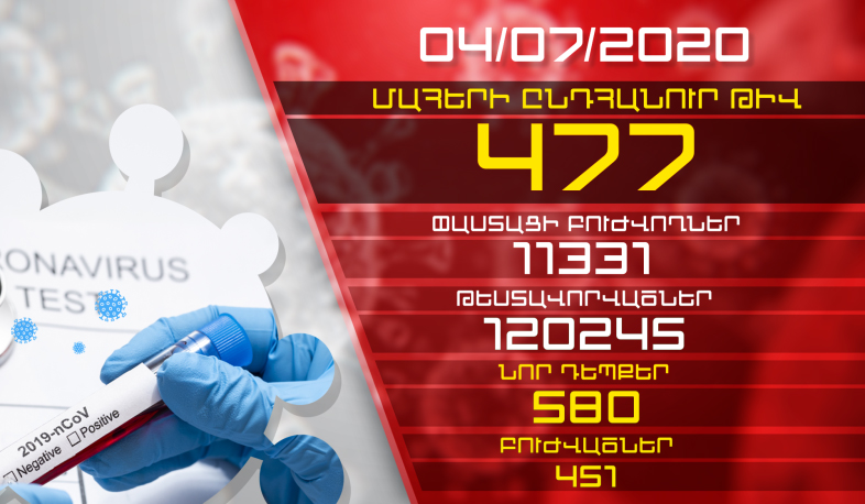 Թարմացում. 04.07.2020. Հաստատվել է կորոնավիրուսի 580 նոր դեպք, առողջացել է 451 մարդ
