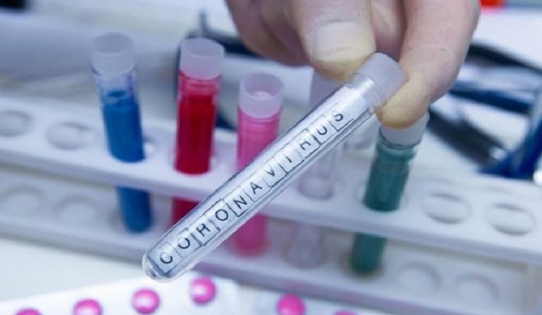 Գյումրու ինֆեկցիոն հիվանդանոցում կորոնավիրուսով 66 հիվանդ է բուժվում