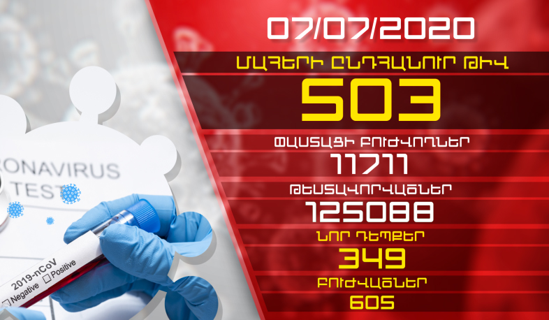 Թարմացում. 07.07.2020. Հաստատվել է կորոնավիրուսի 349 նոր դեպք, առողջացել է 605 մարդ