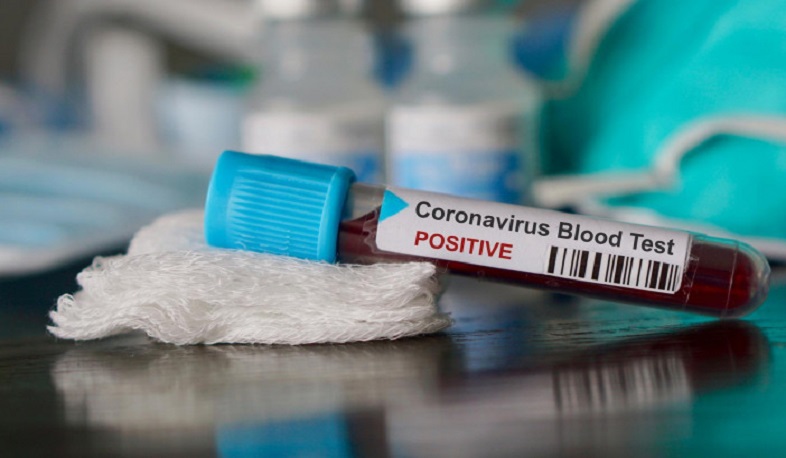 1 new case of coronavirus infection has been confirmed in Artsakh