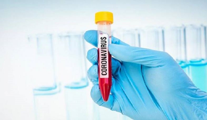 Շիրակի մարզում կորոնավիրուսից առողջացել է 320 մարդ