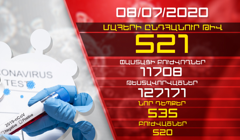 Թարմացում. 08.07.2020 Կորոնավիրուսի նոր դեպքերի թիվը 535 է, ապաքինվել է 520 մարդ