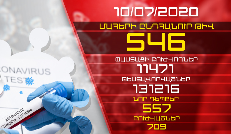 Թարմացում. 10.07.2020. Հաստատվել է կորոնավիրուսի 557 նոր դեպք, առողջացել 709 քաղաքացի