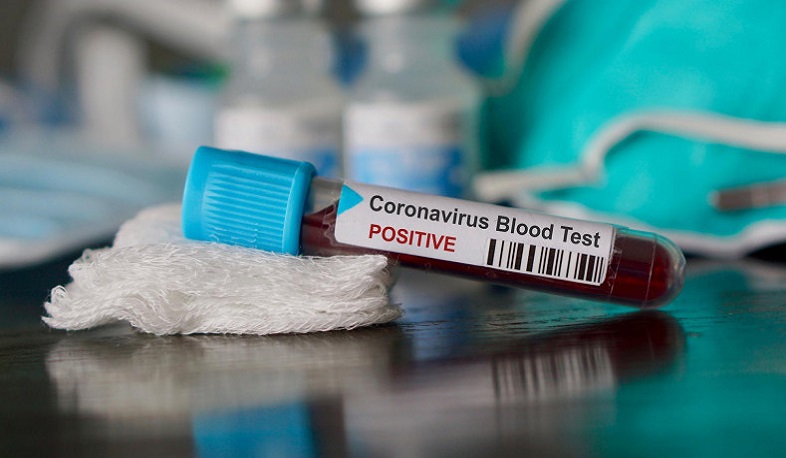 9 new cases of coronavirus have been confirmed in Artsakh