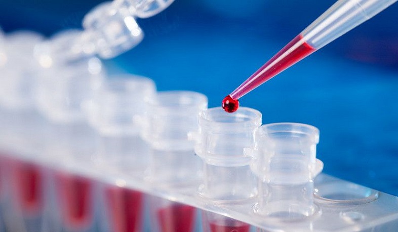 Գյումրու ինֆեկցիոն հիվանդանոցում կորոնավիրուսով 32 հիվանդ է բուժվում