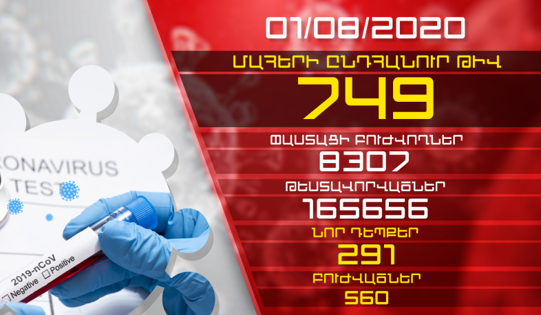 Թարմացում. 01.08.2020. Հաստատվել է կորոնավիրուսի 291 նոր դեպք, առողջացել 560 քաղաքացի