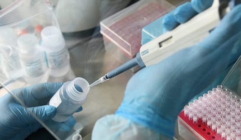 ՌԴ-ում կորոնավիրուսի պատվաստանյութի կլինիկական փորձարկումն ավարտվել է