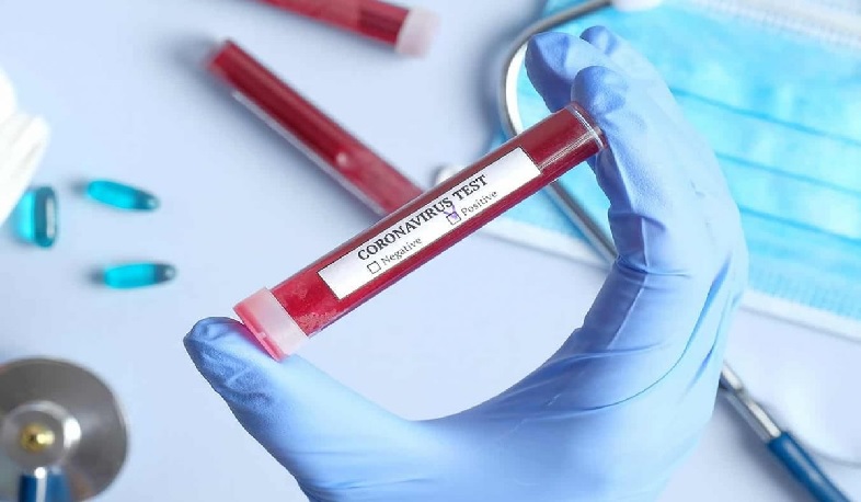 Կորոնավիրուսի 14 նոր դեպք Վրաստանում