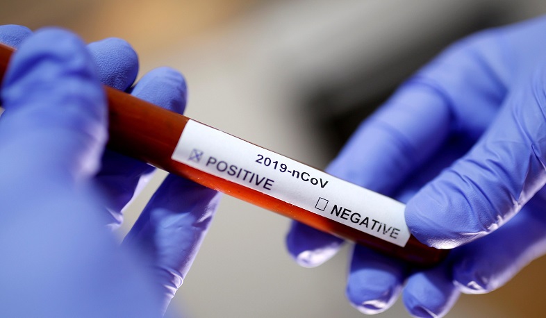 Շիրակի մարզում կորոնավիրուսից բուժվել է 513 մարդ