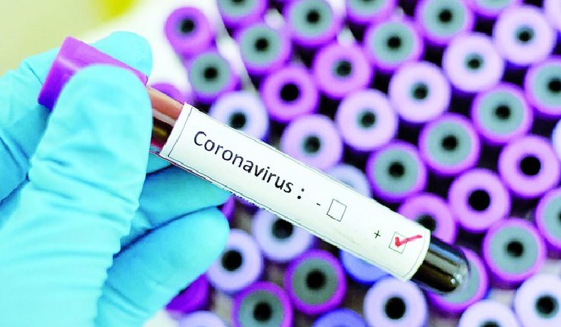 3 new cases of coronavirus have been confirmed in Artsakh