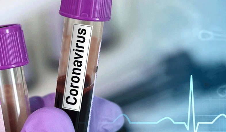 2 new cases of coronavirus have been confirmed in Artsakh․ The infected are residents of Stepanakert