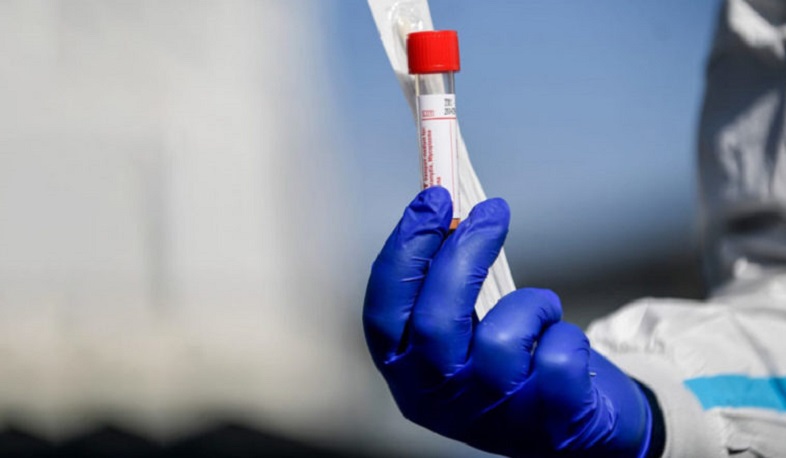 3 new cases of coronavirus have been confirmed in Artsakh