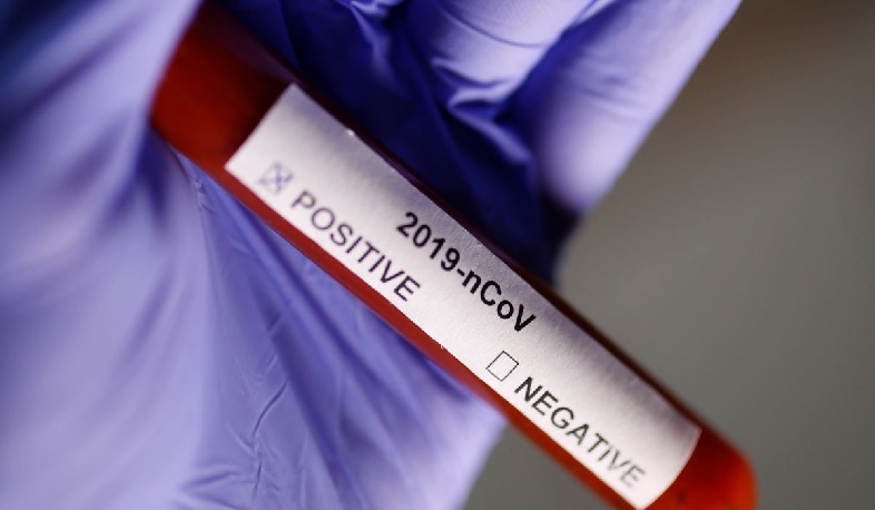 Արցախում հաստատվել է կորոնավիրուսի 4 նոր դեպք