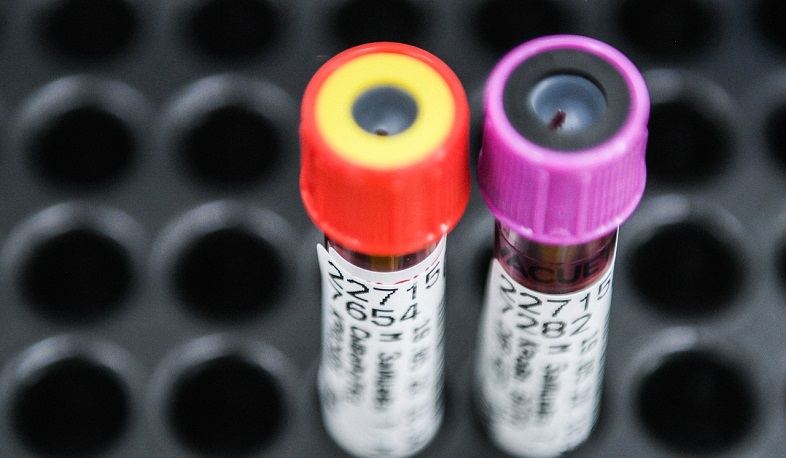 Այլ հիվանդությունից կորոնավիրուսի հակամարմինների առաջացման վարկած կա