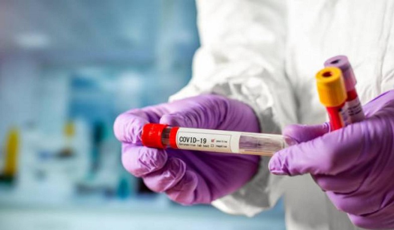 Արցախում հաստատվել է կորոնավիրուսի 9 նոր դեպք