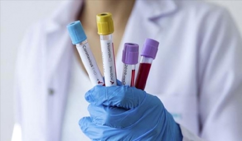 In case of a positive COVID test result, the authenticity of the test will be rechecked