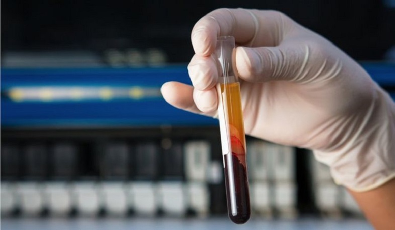 Արյան հետազոտությունը հնարավորություն կտա հայտնաբերել չարորակ ուռուցքների շուրջ 50 տեսակ