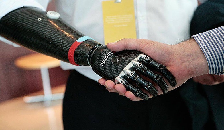 Վիրավոր տղաները կունենան ձեռքի գերժամանակակից պրոթեզներ. պատգամավոր