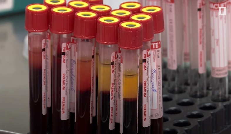 Քովիդով վարակվածները վիրուսի նոր շտամով հավանաբար չեն վարակվի