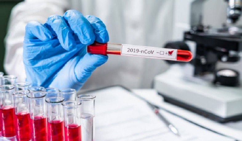 Թարմացում 21.01.2021 Հաստատվել է կորոնավիրուսի 307 նոր դեպք, առողջացել 189 մարդ