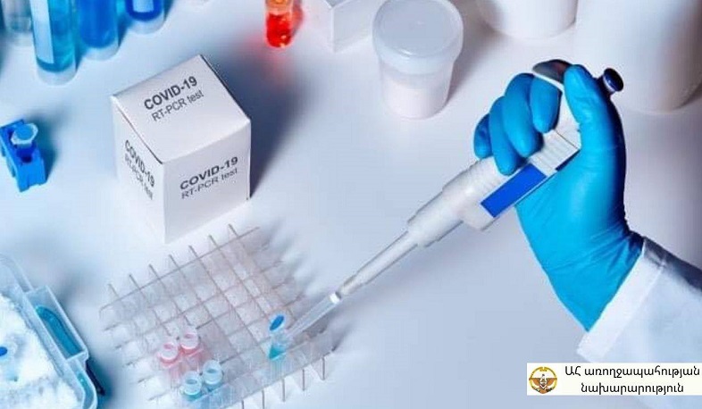 9 new cases of coronavirus disease have been confirmed in Artsakh