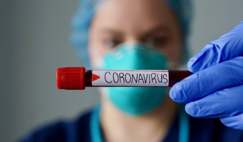4 new cases of coronavirus disease have been confirmed in Artsakh