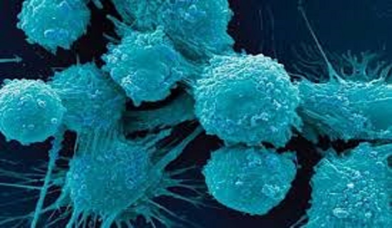 2020-ին Արցախում գրանցվել է քաղցկեղի 260 դեպք