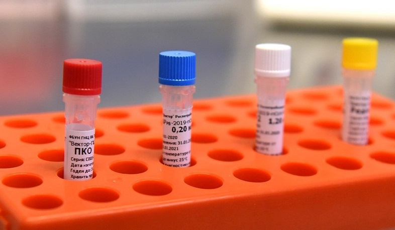 В Арцахе выявлено 4 случая заболевания коронавирусом