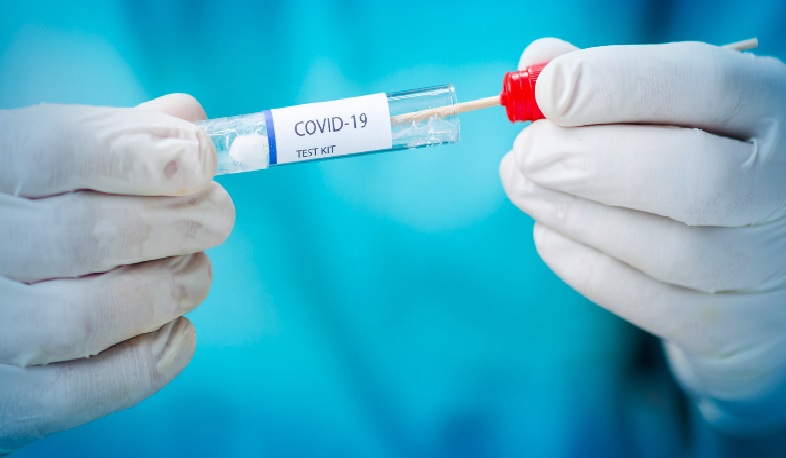Վրաստանում արձանագրվել է կորոնավիրուսի 490 նոր դեպք, ապաքինվել է 219 հիվանդ