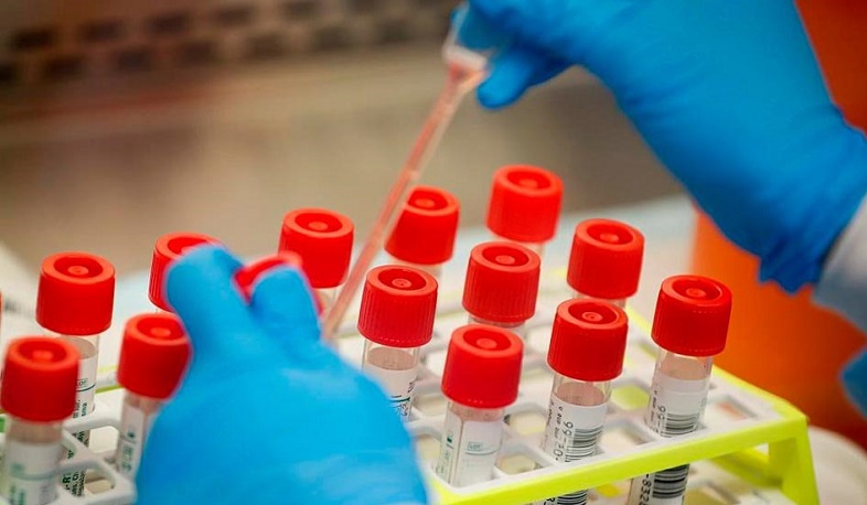 Թարմացում. 28.03.2021. Հաստատվել է կորոնավիրուսի 777 նոր դեպք, առողջացել է 603 մարդ