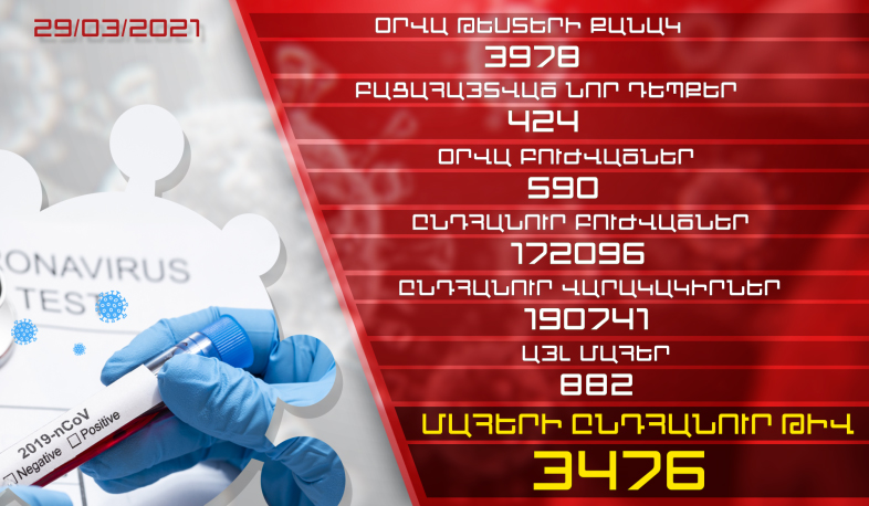 Թարմացում. 29.03.2021. Հաստատվել է կորոնավիրուսի 424 նոր դեպք, առողջացել է 590 մարդ