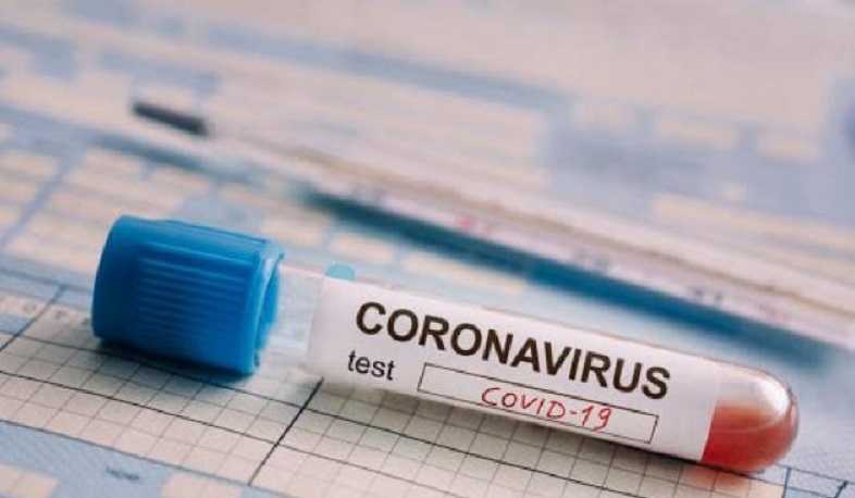 В Арцахе выявлено 7 случаев заболевания коронавирусом