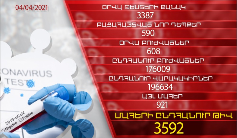 Թարմացում. 04.04.2021. Հաստատվել է կորոնավիրուսի 590 նոր դեպք, առողջացել 608 քաղաքացի